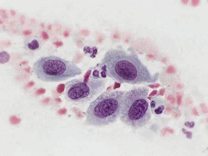 上皮细胞（Epithelial Cell）